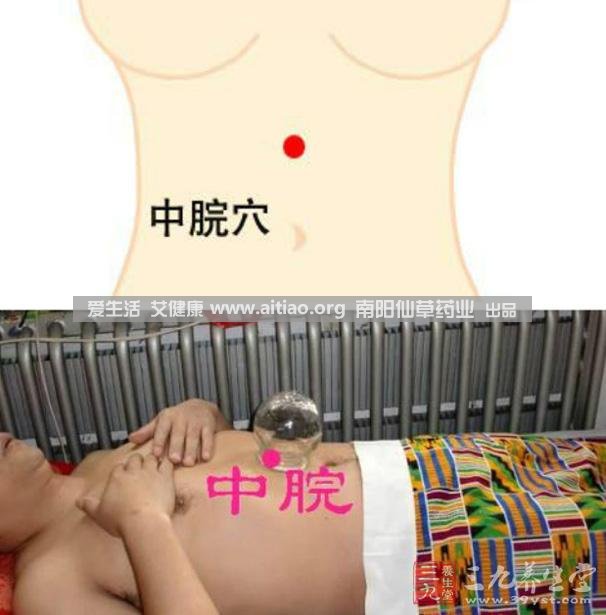 中脘穴位于腹部正中線(xiàn)，臍上4寸的位置上。每天艾灸10-15分鐘，能有效緩解胃部不適的癥狀，同時(shí)有助于祛濕。